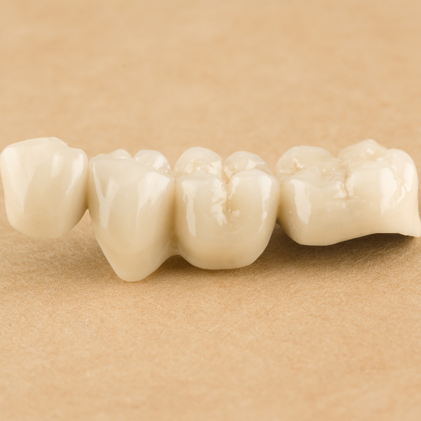 Dental Bridges