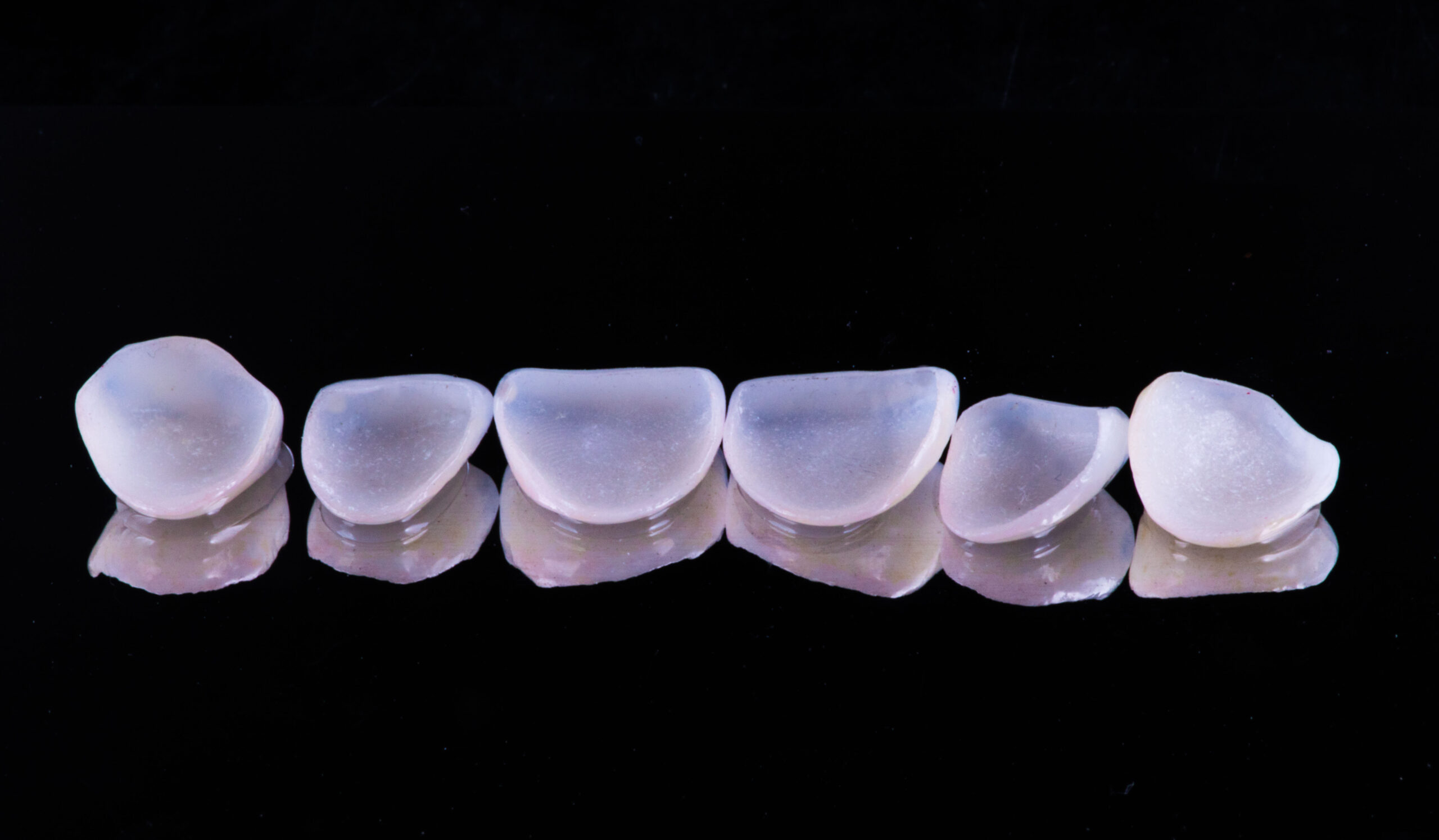 Porcelain Veneers