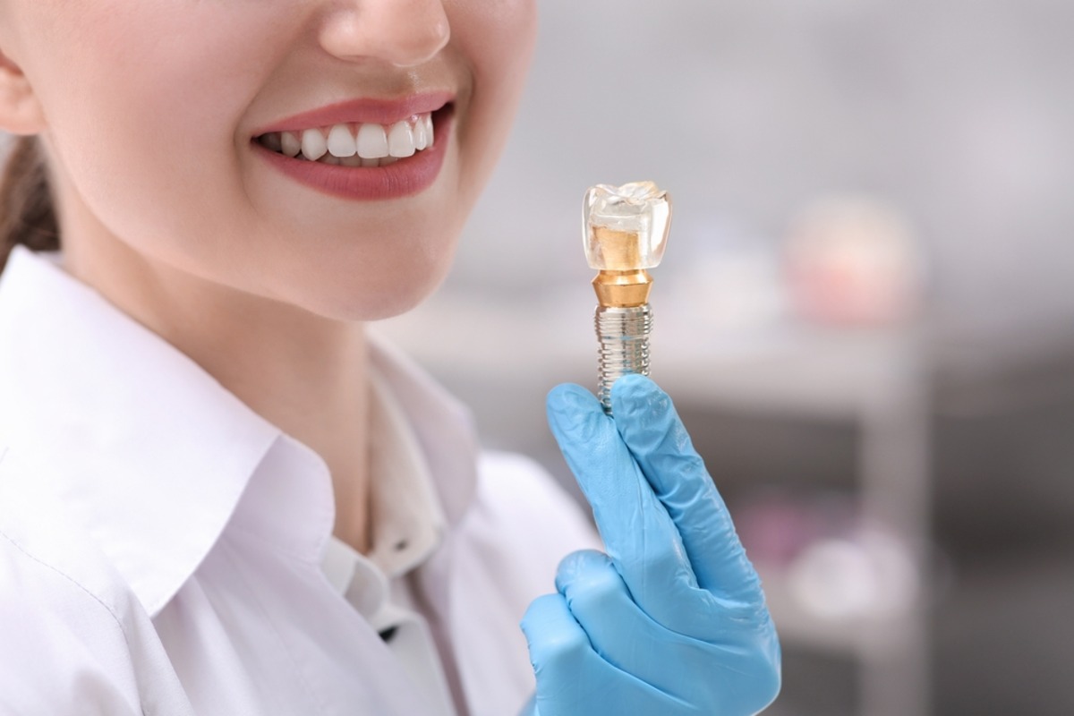 dental implants near me in richmond hill