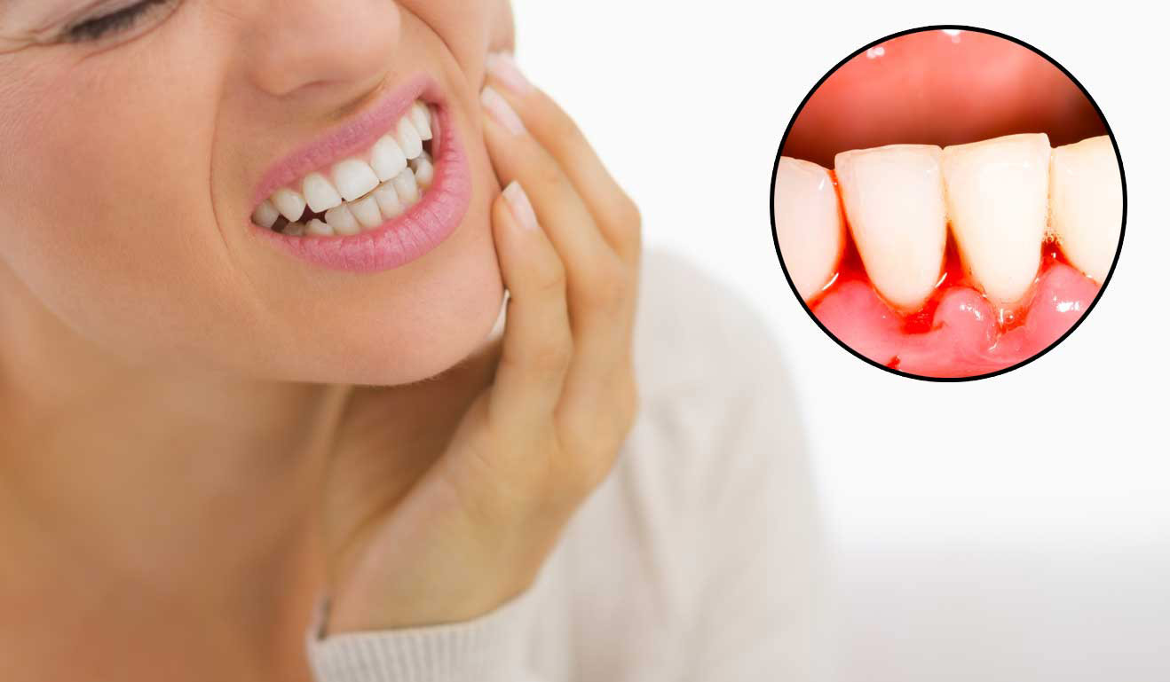 Most Common Causes Of Gum Bleeding