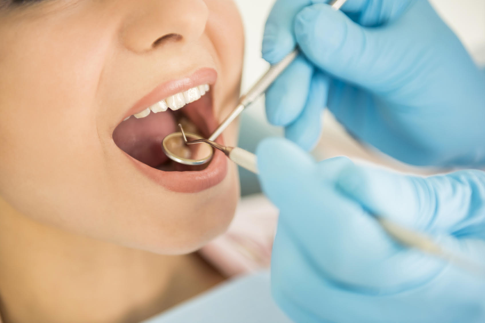 What Are Dental Fillings?