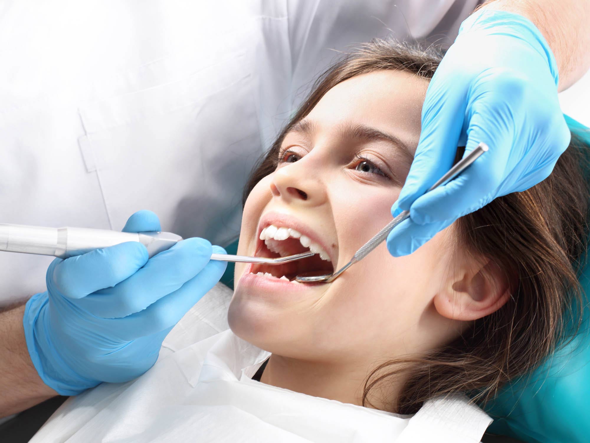 What Are Dental Sealants?