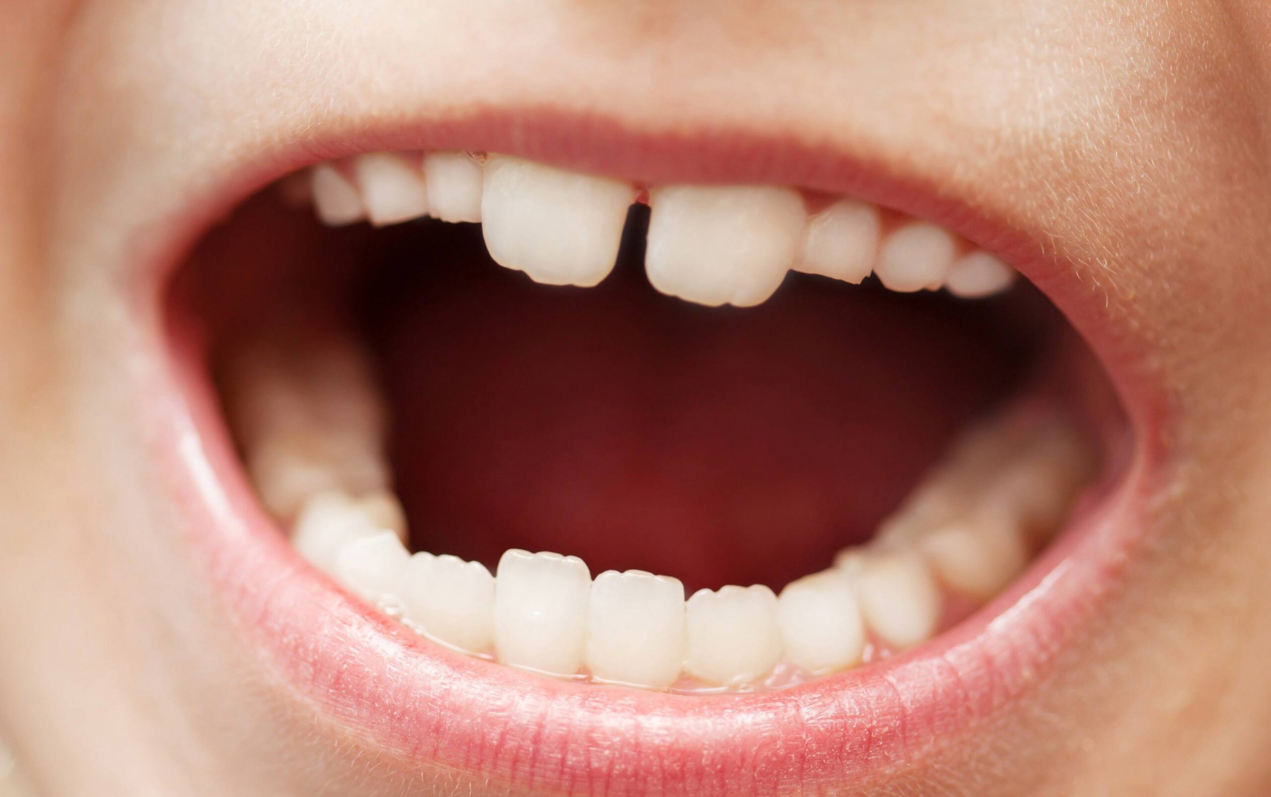 Your Child’s New Adult Teeth