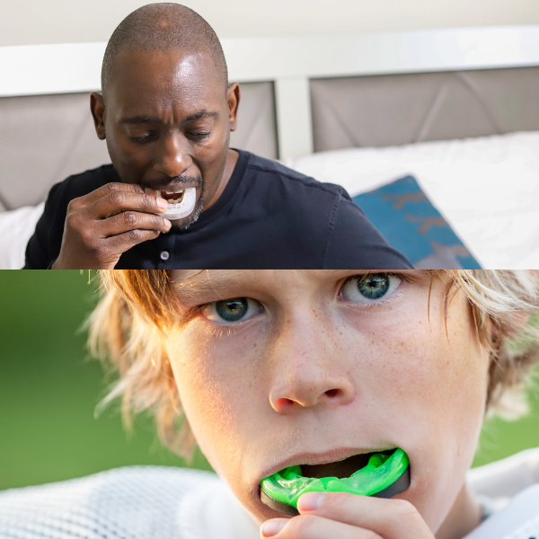 Mouth Guards in Richmond Hill